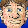Hard water can contribute to bad skin.